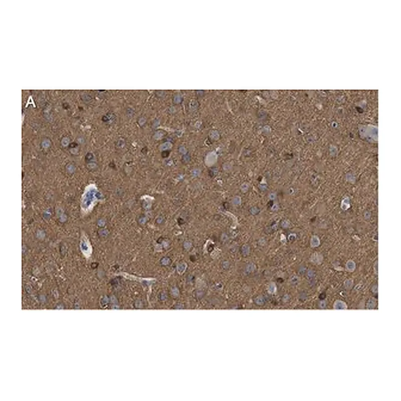Merck Anti-Tau-1 Antibody, clone PC1C6 ZooMAb Mouse Monoclonal