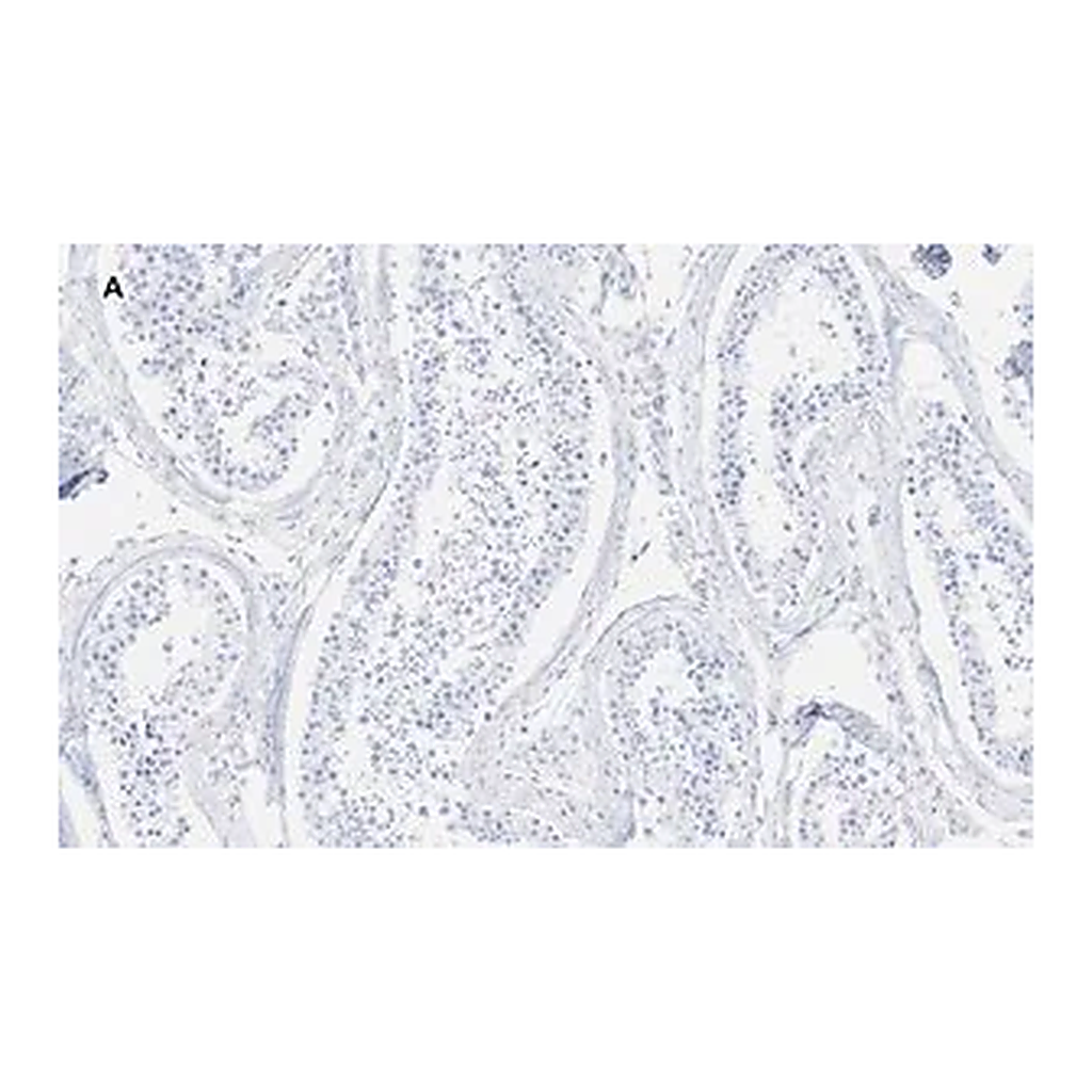 Merck Anti-GAPDH Antibody, clone 10B13, ZooMAb Rabbit Monoclonal