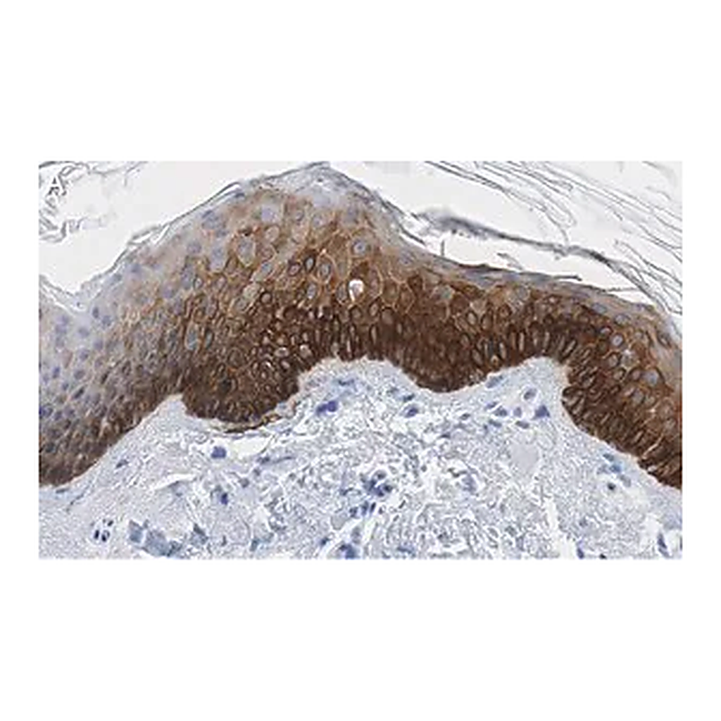 Merck Anti-Cytokeratin-14 Antibody, clone 1D15 ZooMAb Rabbit Monoclonal
