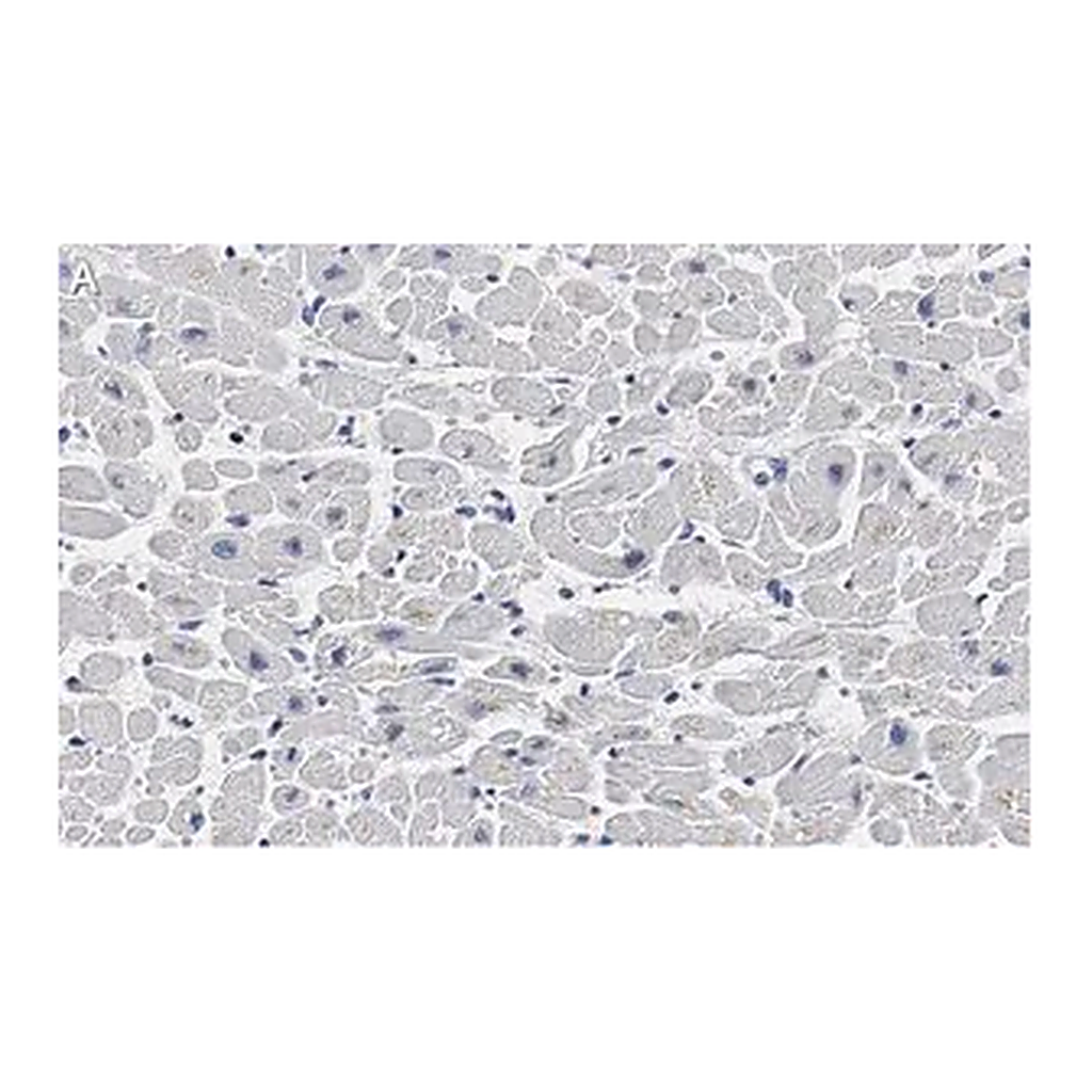 Merck Anti-Cardiac Troponin I Antibody, clone 1F23, ZooMAb Rabbit Monoclonal