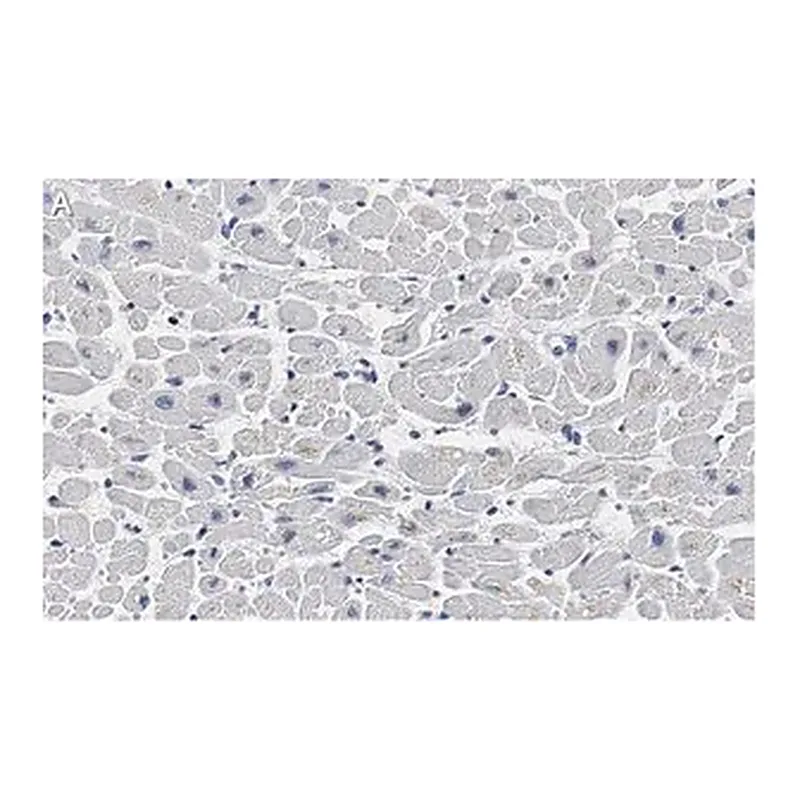 Merck Anti-Cardiac Troponin I Antibody, clone 1F23, ZooMAb Rabbit Monoclonal