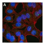 Merck Anti-Linear Ubiquitin Antibody, clone 1E3 ZooMAb Rabbit Monoclonal