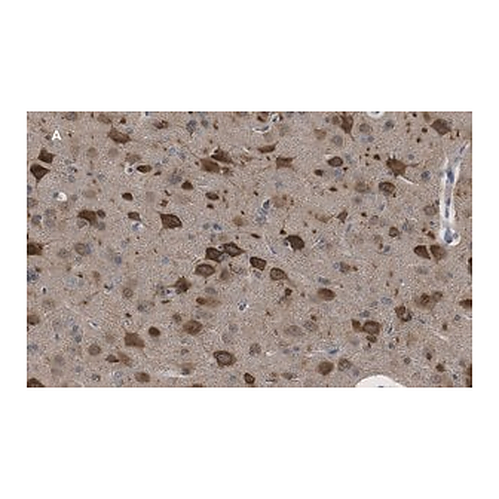 Merck Anti-LC3B Antibody, clone 12K5, ZooMAb Rabbit Monoclonal