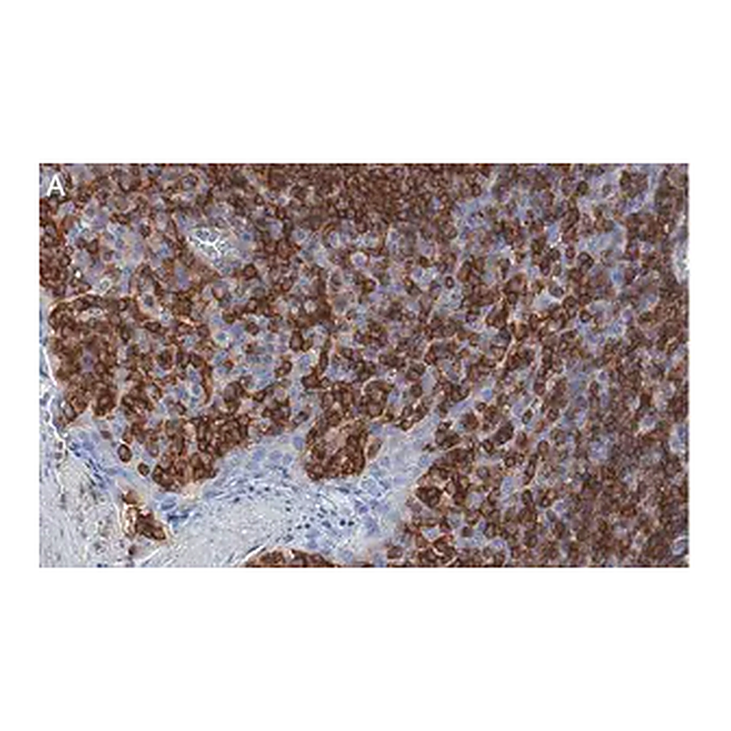 Merck Anti-TIGIT Antibody, clone 1D20 ZooMAb Rabbit Monoclonal