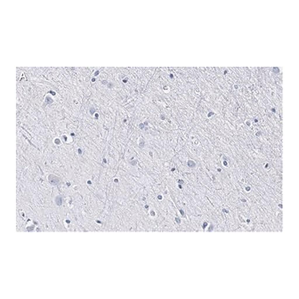 Merck Anti-BLBP/FABP7 Antibody, clone 7I23, ZooMAb Rabbit Monoclonal