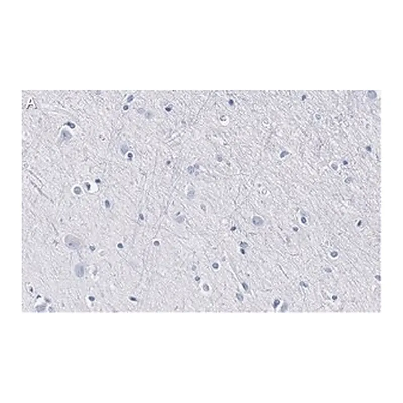 Merck Anti-BLBP/FABP7 Antibody, clone 7I23, ZooMAb Rabbit Monoclonal