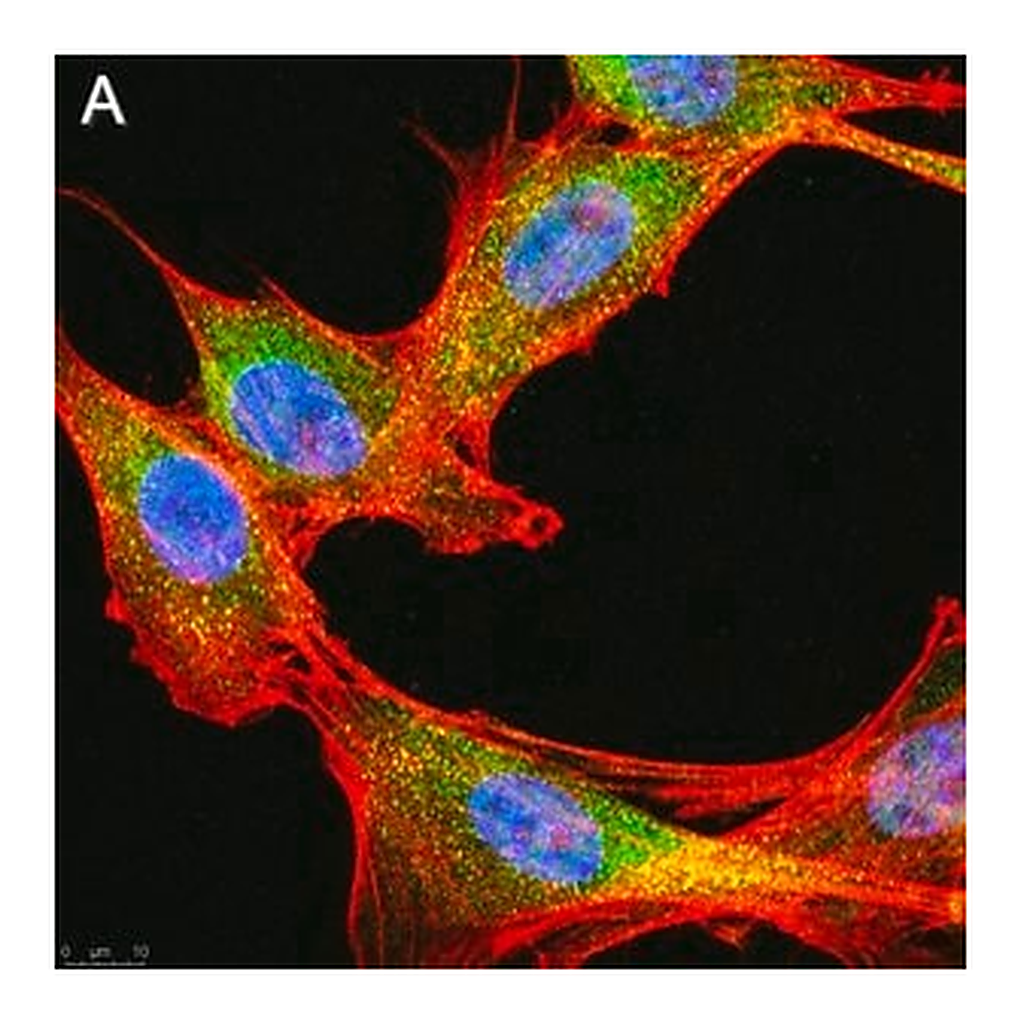 Merck Anti-phospho-IRE-1α (Ser724) Antibody, clone 1M2 ZooMAb Rabbit Monoclonal