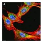 Merck Anti-phospho-IRE-1α (Ser724) Antibody, clone 1M2 ZooMAb Rabbit Monoclonal