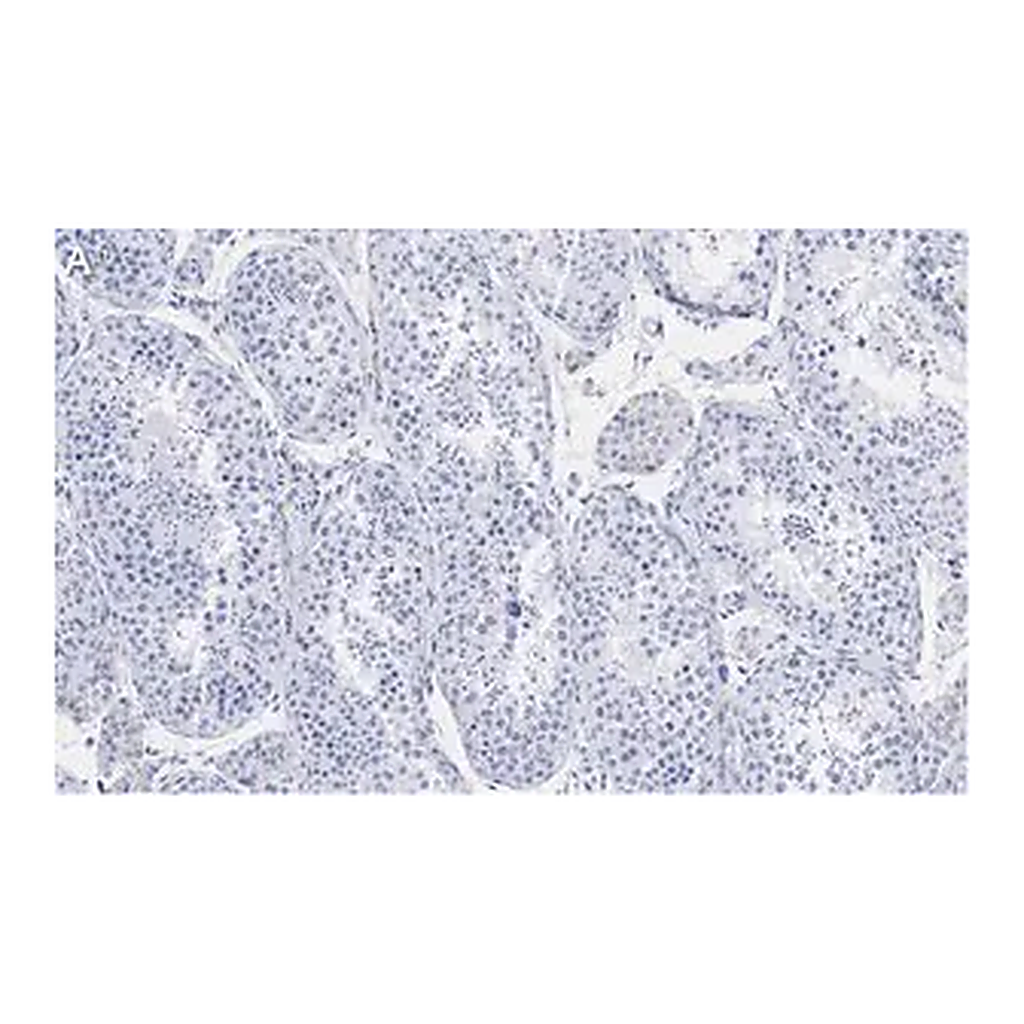 Merck Anti-Ac-α-Tubulin (Lys40) Antibody, clone 1L10, ZooMAb Rabbit Monoclonal