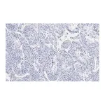 Merck Anti-Ac-α-Tubulin (Lys40) Antibody, clone 1L10, ZooMAb Rabbit Monoclonal