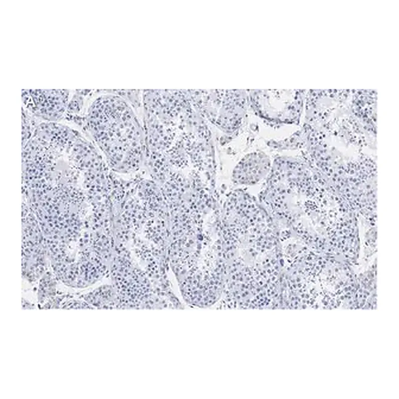 Merck Anti-Ac-α-Tubulin (Lys40) Antibody, clone 1L10, ZooMAb Rabbit Monoclonal