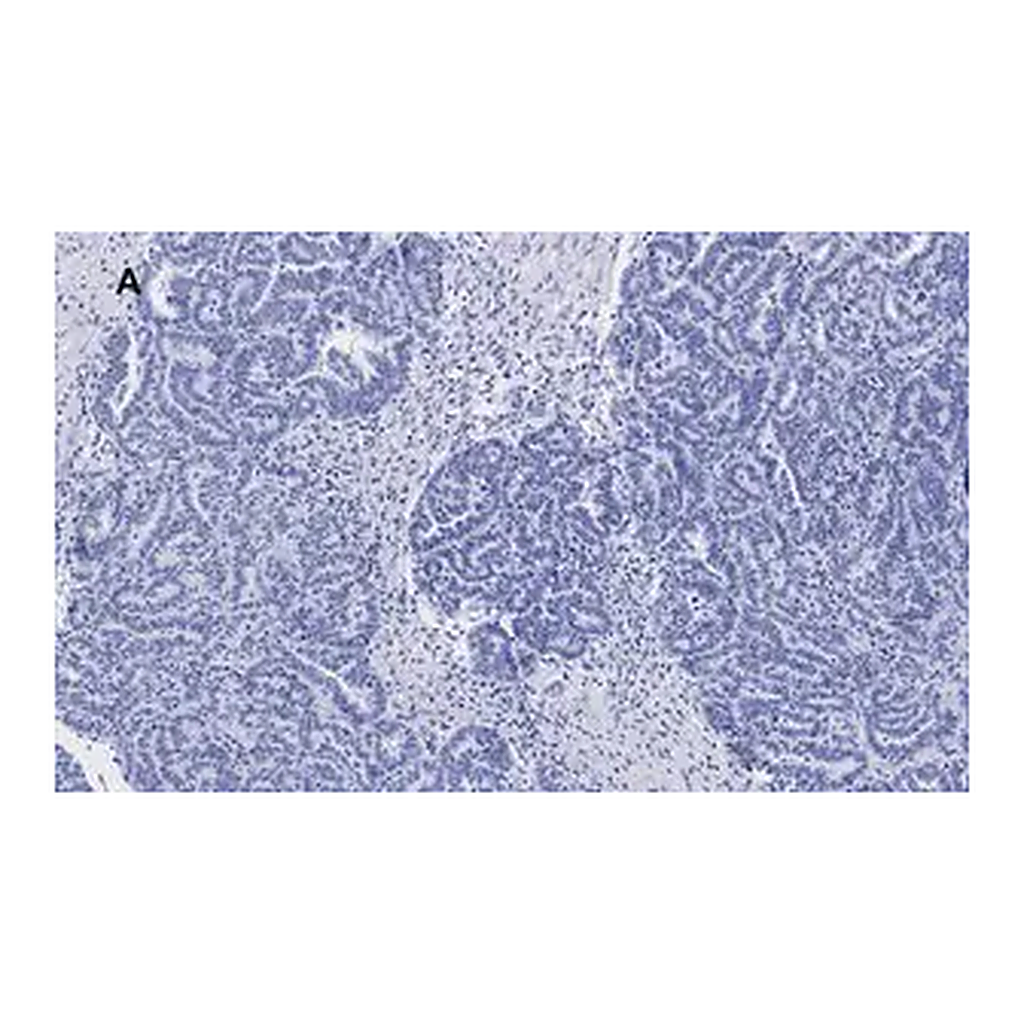 Merck Anti-p53 Antibody, clone 6O23, ZooMAb Rabbit Monoclonal