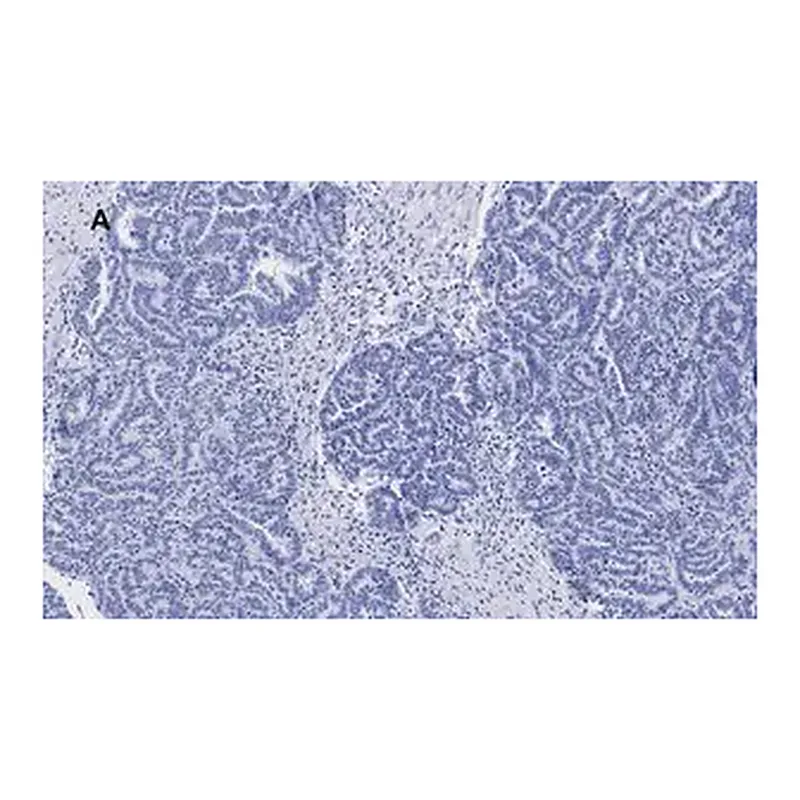 Merck Anti-p53 Antibody, clone 6O23, ZooMAb Rabbit Monoclonal