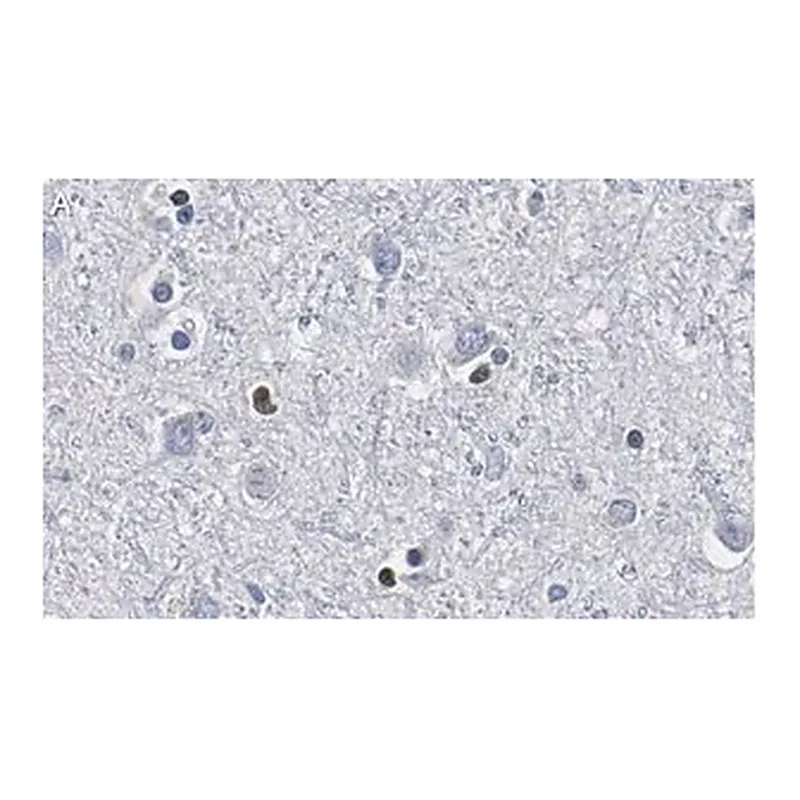Merck Anti-Olig2 Antibody, clone 211F1.1 ZooMAb Mouse Monoclonal