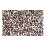 Merck Anti-MyoD Antibody, clone 1F22 ZooMAb Rabbit Monoclonal