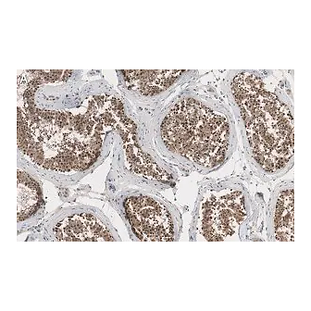 Merck Anti-EZHIP/CXorf67 Antibody, clone 1J8 ZooMAb Rabbit Monoclonal