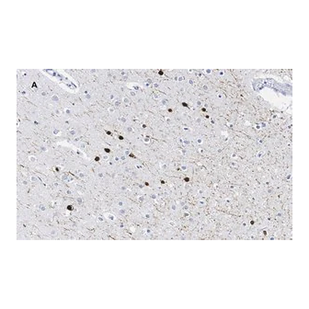 Merck Anti-Calretinin Antibody, clone 3K22, ZooMAb Rabbit Monoclonal