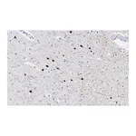 Merck Anti-Calretinin Antibody, clone 3K22, ZooMAb Rabbit Monoclonal