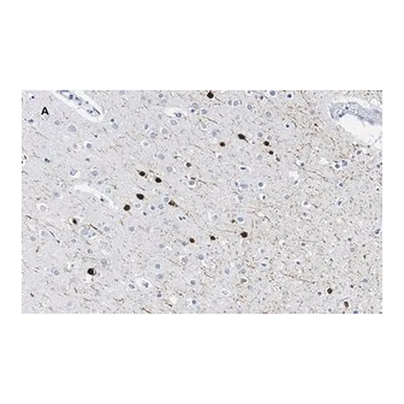 Merck Anti-Calretinin Antibody, clone 3K22, ZooMAb Rabbit Monoclonal