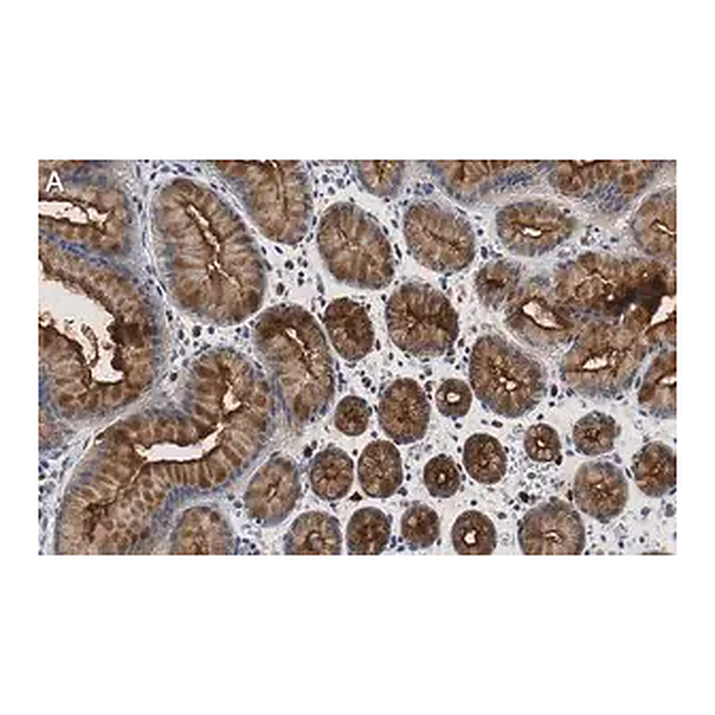 Merck Anti-MUC1 Antibody, clone 1F23 ZooMAb Rabbit Monoclonal
