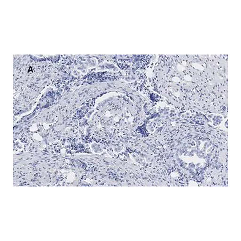 Merck Anti-phospho JNK (Thr183, Tyr185) Antibody, clone 3F7, ZooMAb Rabbit Monoclonal