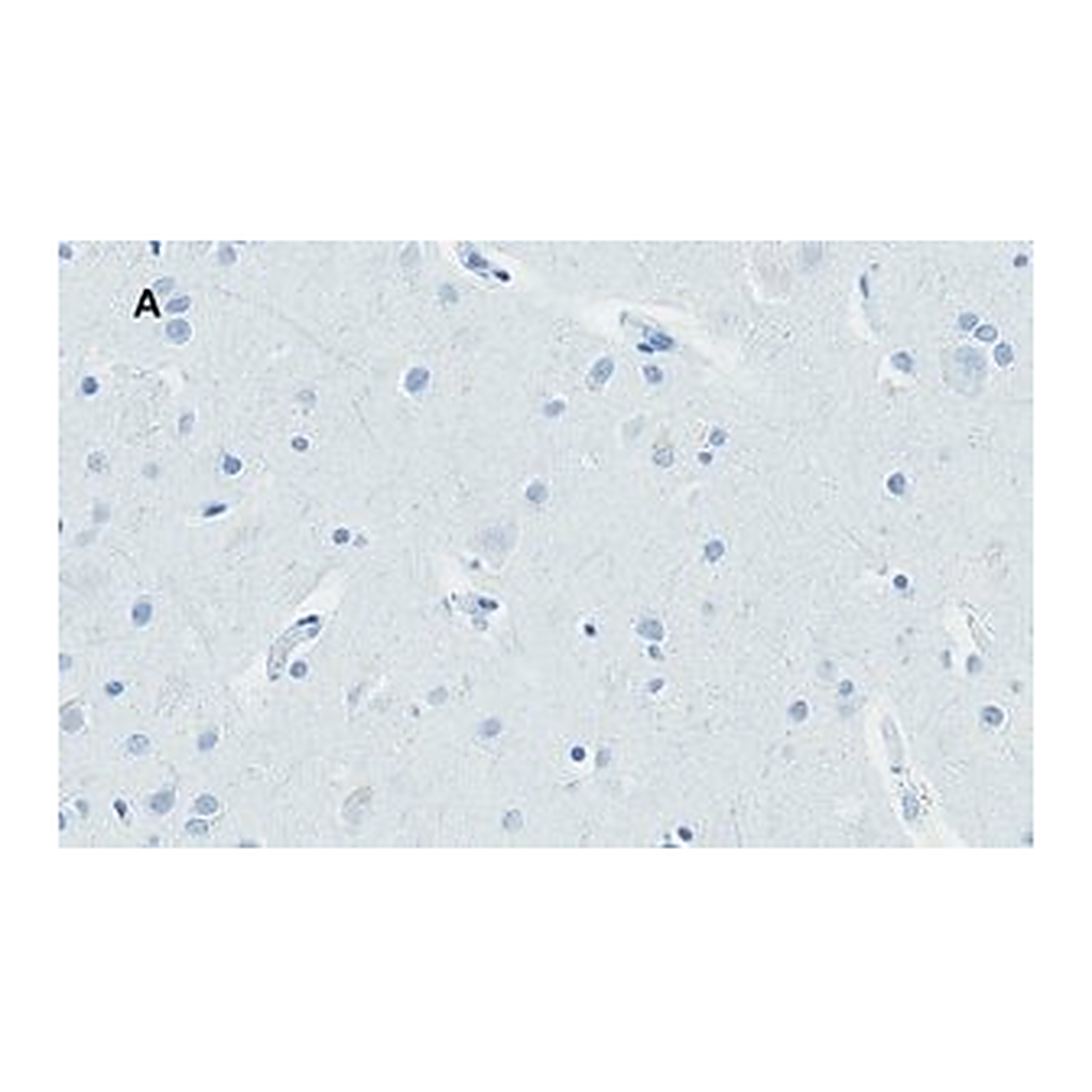 Merck Anti-Huntingtin Protein Antibody, clone 1M11, ZooMAb Rabbit Monoclonal
