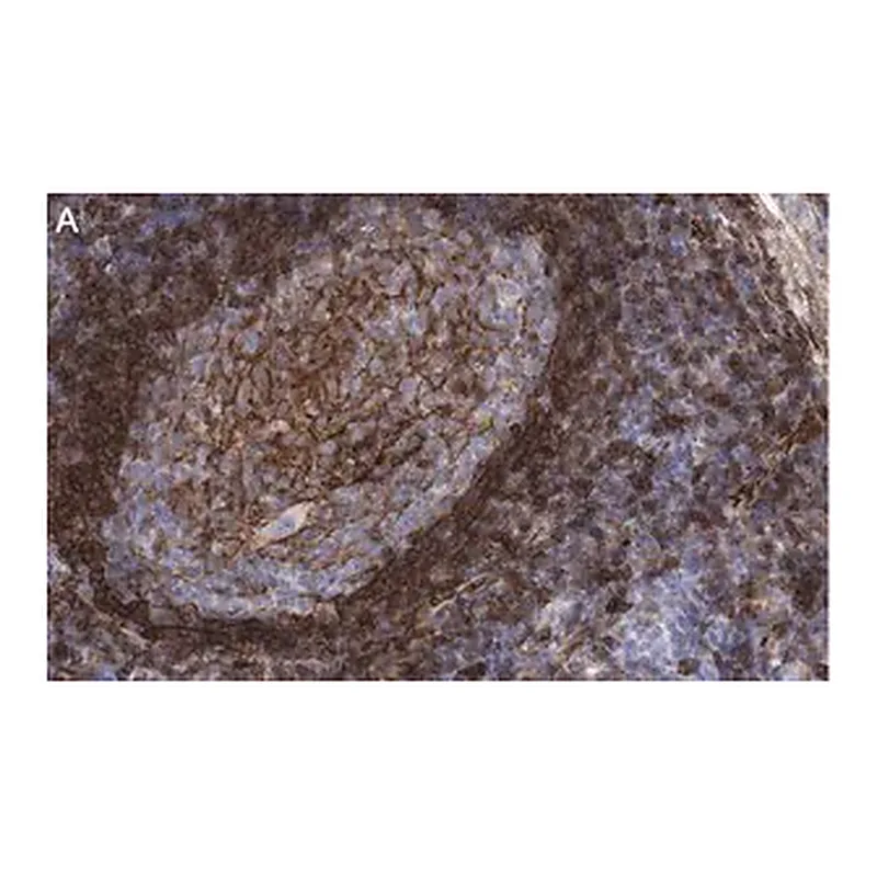 Merck Anti-CD73 (NT5E) Antibody, clone 1F22 ZooMAb Rabbit Monoclonal