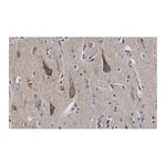 Merck Anti-TOMM20 Antibody, clone 5H22 ZooMAb Rabbit Monoclonal