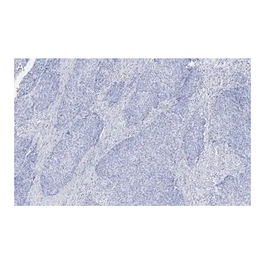Merck Anti-Integrin β1 Antibody, clone 1A27 , ZooMAb Rabbit Monoclonal