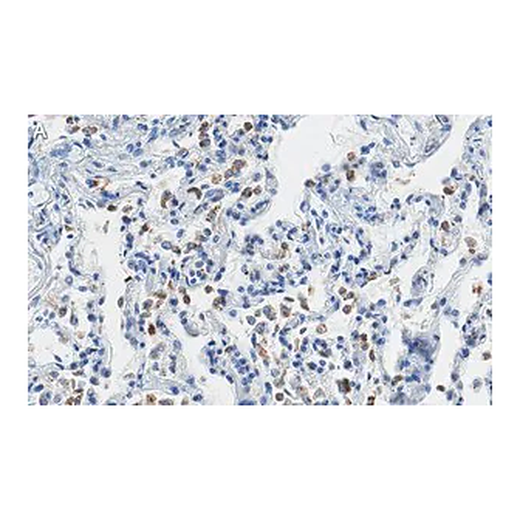 Merck Anti-SFTPC Antibody, clone 3F18 ZooMAb Rabbit Monoclonal