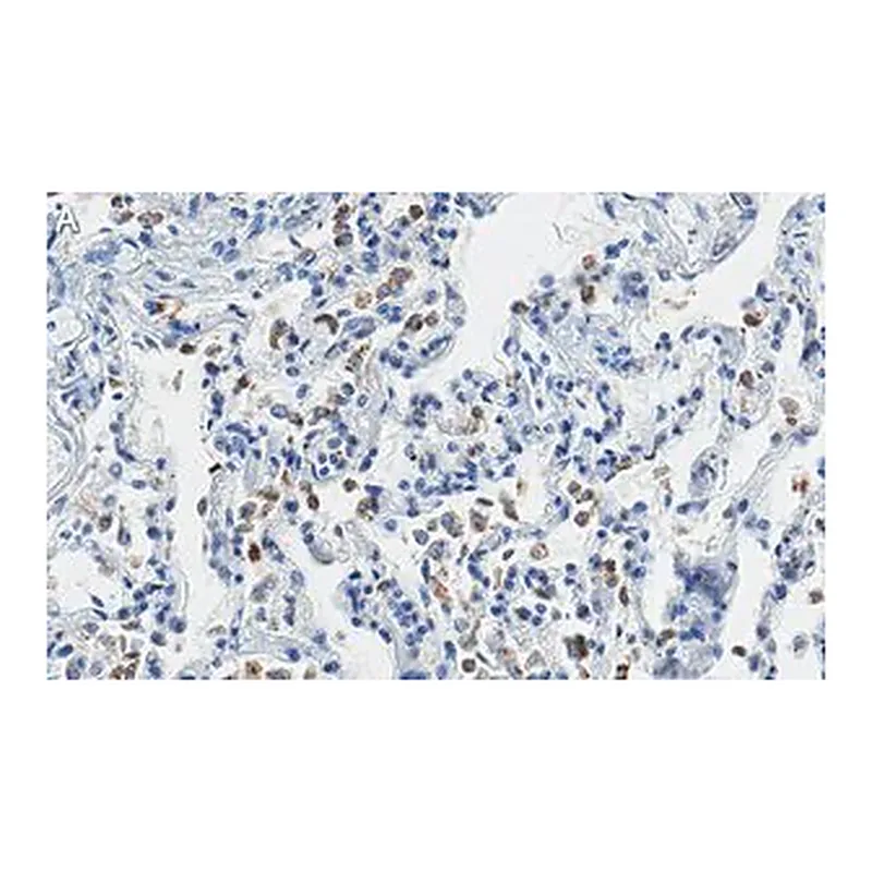 Merck Anti-SFTPC Antibody, clone 3F18 ZooMAb Rabbit Monoclonal