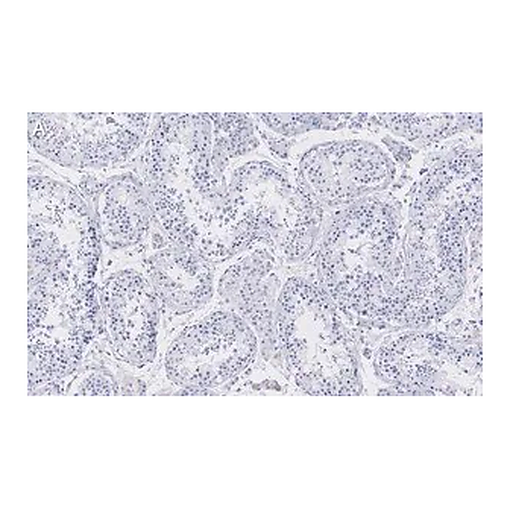 Merck Anti-Golgin-97 Antibody, clone 4K16, ZooMAb Rabbit Monoclonal