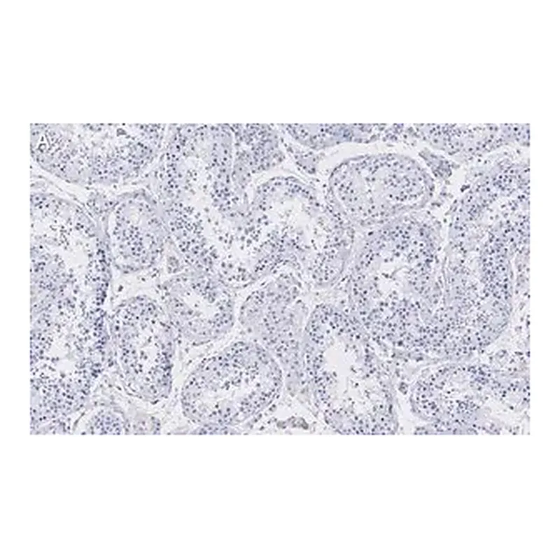 Merck Anti-Golgin-97 Antibody, clone 4K16, ZooMAb Rabbit Monoclonal