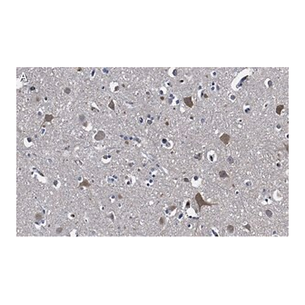 Merck Anti-Stathmin-2 Antibody, clone 1B3 ZooMAb Rabbit Monoclonal