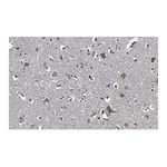 Merck Anti-Stathmin-2 Antibody, clone 1B3 ZooMAb Rabbit Monoclonal