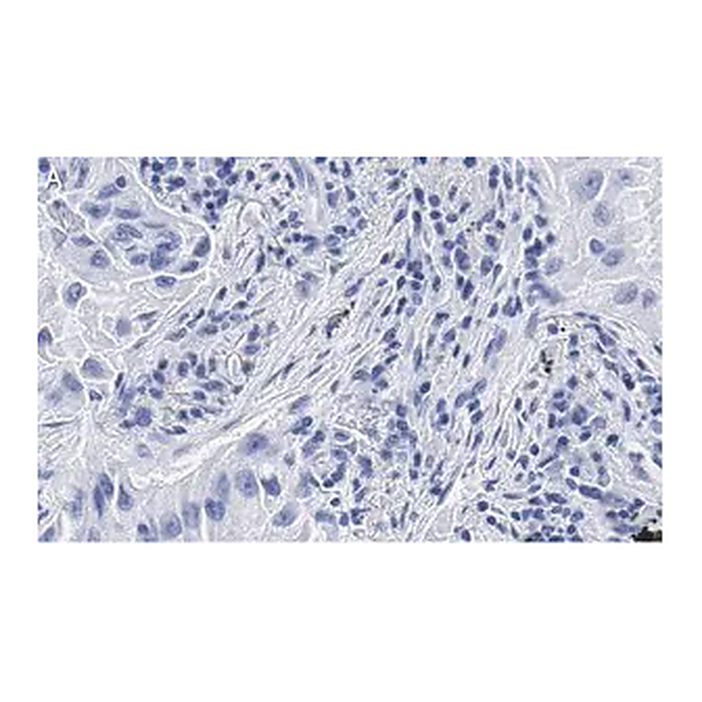 Merck Anti-uPAR Antibody, clone 2G10 , ZooMAb Rabbit Monoclonal