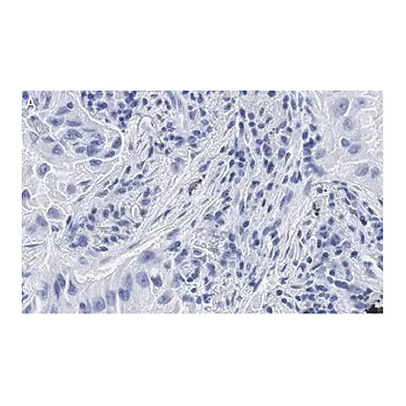 Merck Anti-uPAR Antibody, clone 2G10 , ZooMAb Rabbit Monoclonal