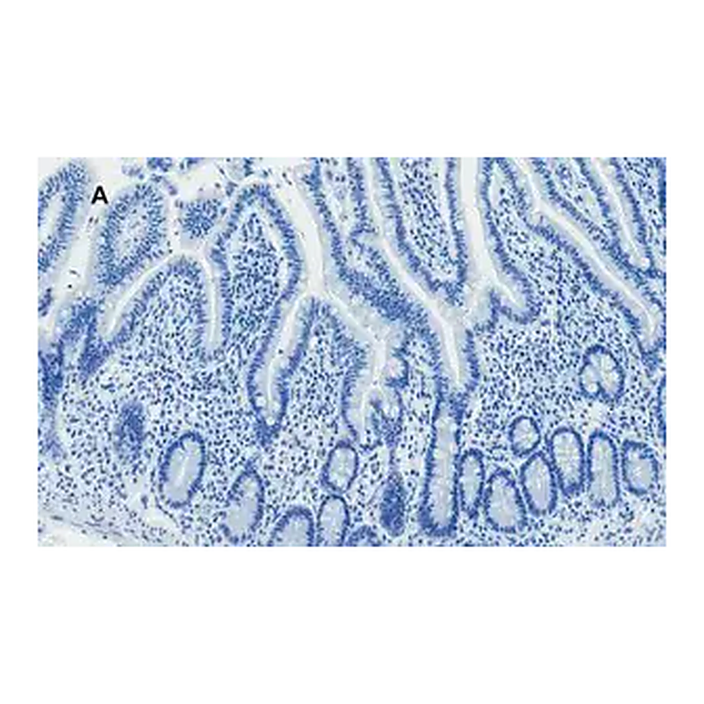 Merck Anti-AMPK alpha Antibody, clone 2D22, ZooMAb Rabbit Monoclonal