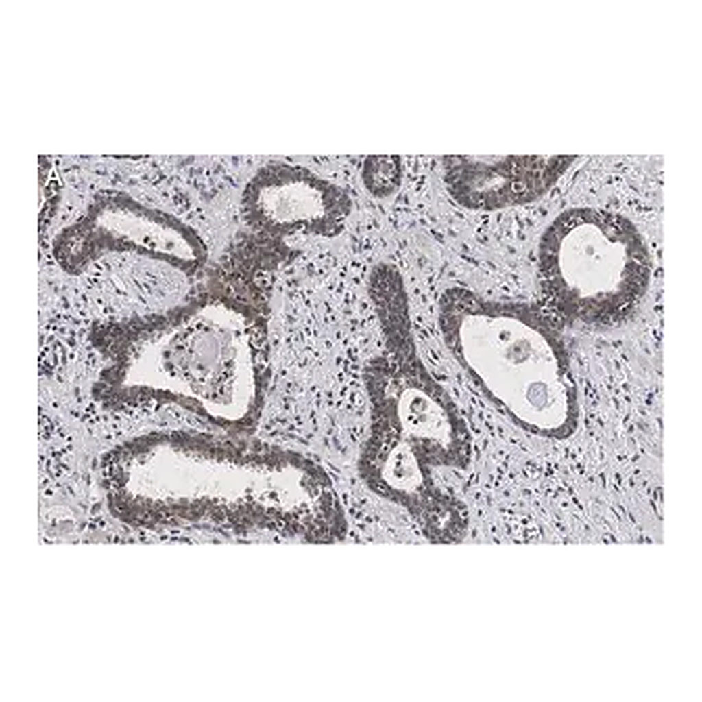 Merck Anti-RAR-alpha Antibody, clone 3L14, ZooMAb Rabbit Monoclonal
