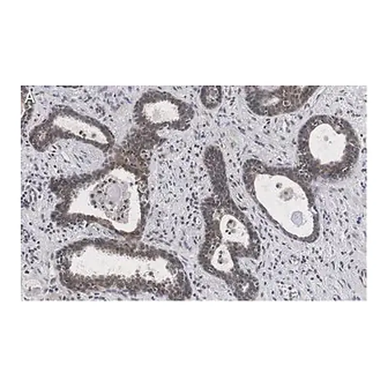 Merck Anti-RAR-alpha Antibody, clone 3L14, ZooMAb Rabbit Monoclonal