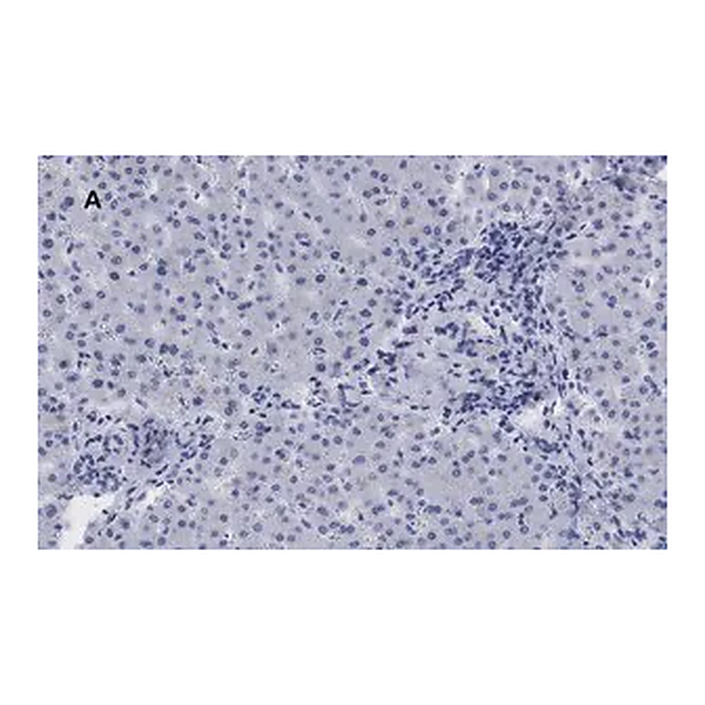 Merck Anti-LDL Receptor Antibody, clone 2N19, ZooMAb Rabbit Monoclonal