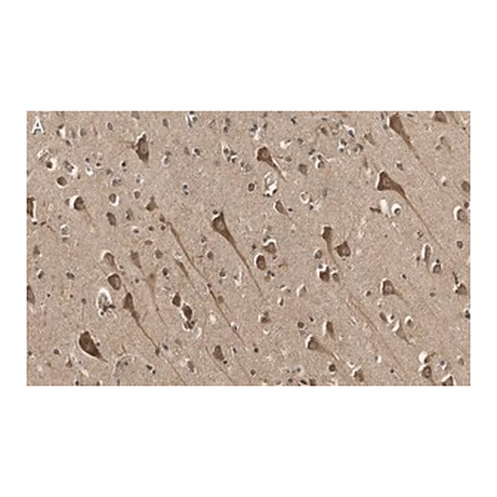 Merck Anti-TPH-1 Antibody, clone 3J7 ZooMAb Rabbit Monoclonal