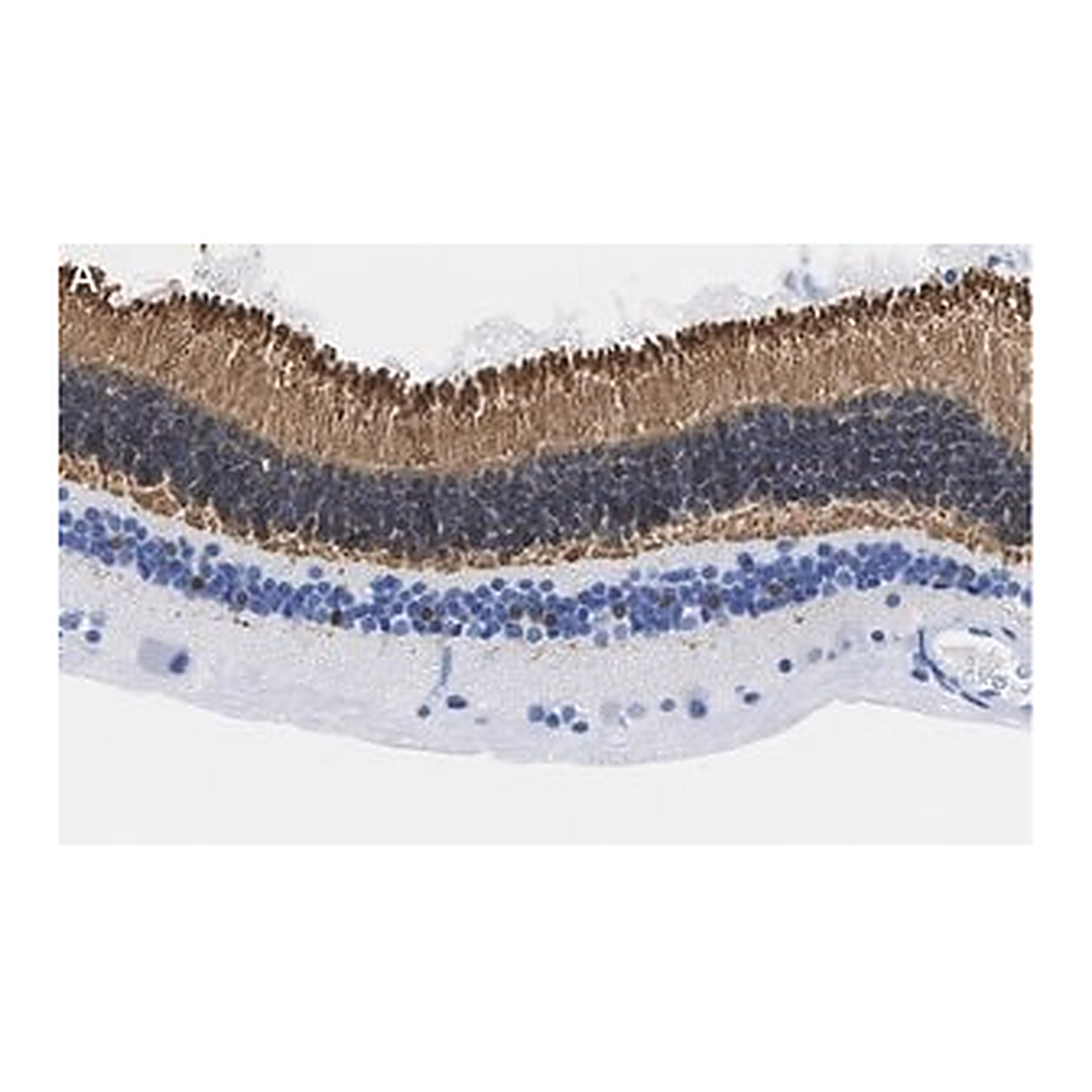 Merck Anti-Recoverin Antibody, clone 1K10 ZooMAb Rabbit Monoclonal