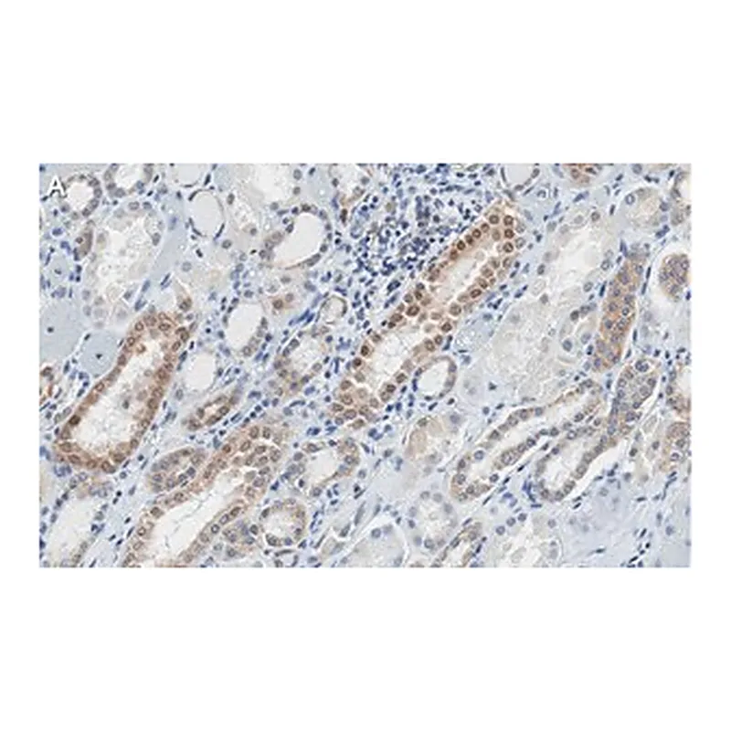 Merck Anti-STAT1 (isoform alpha) Antibody, clone 1D4 ZooMAb Rabbit Monoclonal