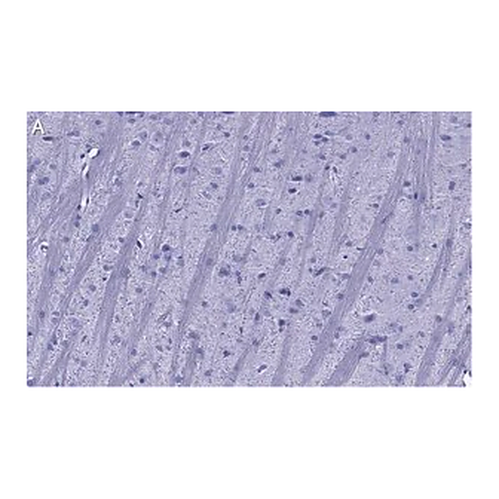Merck Anti-Synaptophysin Antibody, clone 1G7, ZooMAb Rabbit Monoclonal