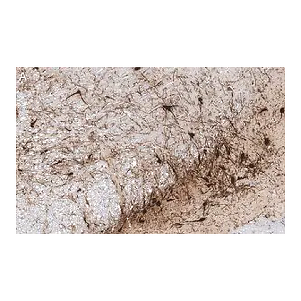 Merck Anti-Tyrosine Hydroxylase Antibody, clone 20/40/15 ZooMAb Mouse Monoclonal