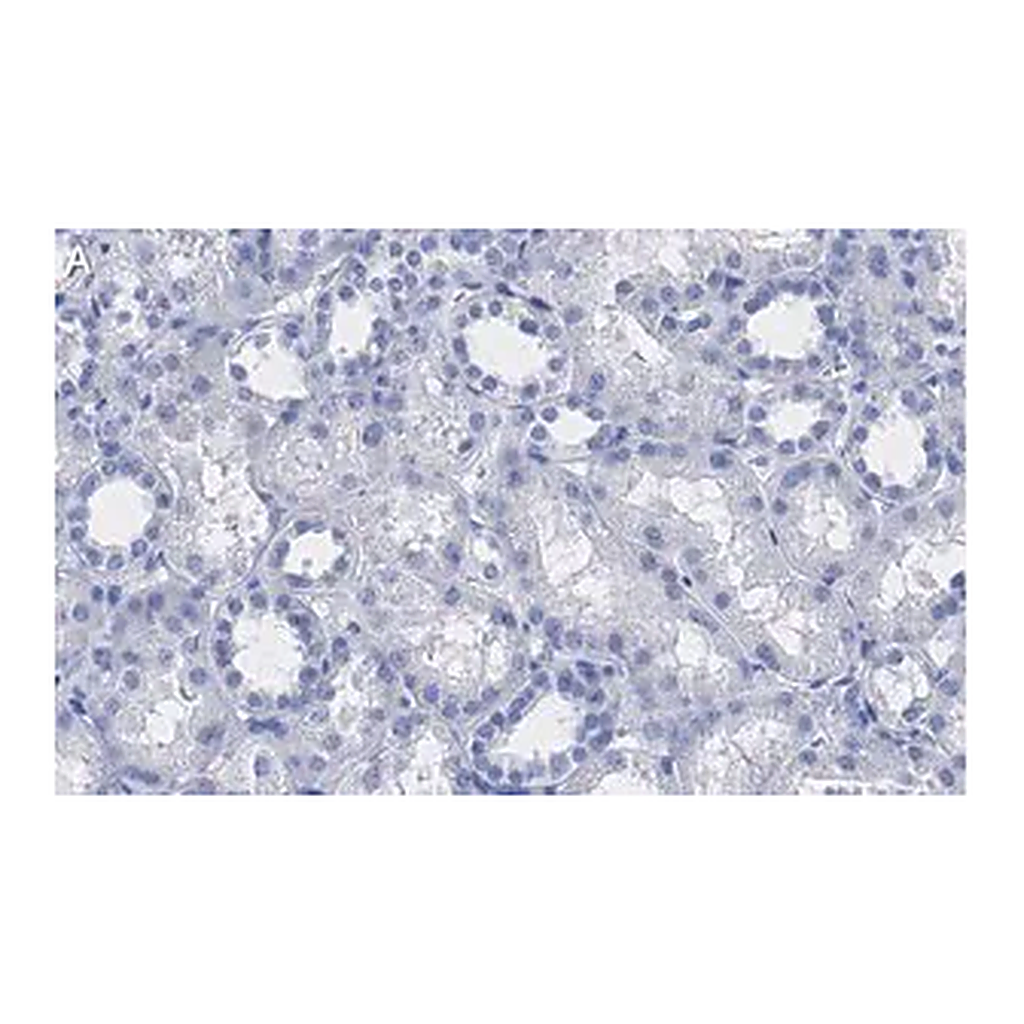 Merck Anti-VDAC1 Antibody, clone 3M22, ZooMAb Rabbit Monoclonal