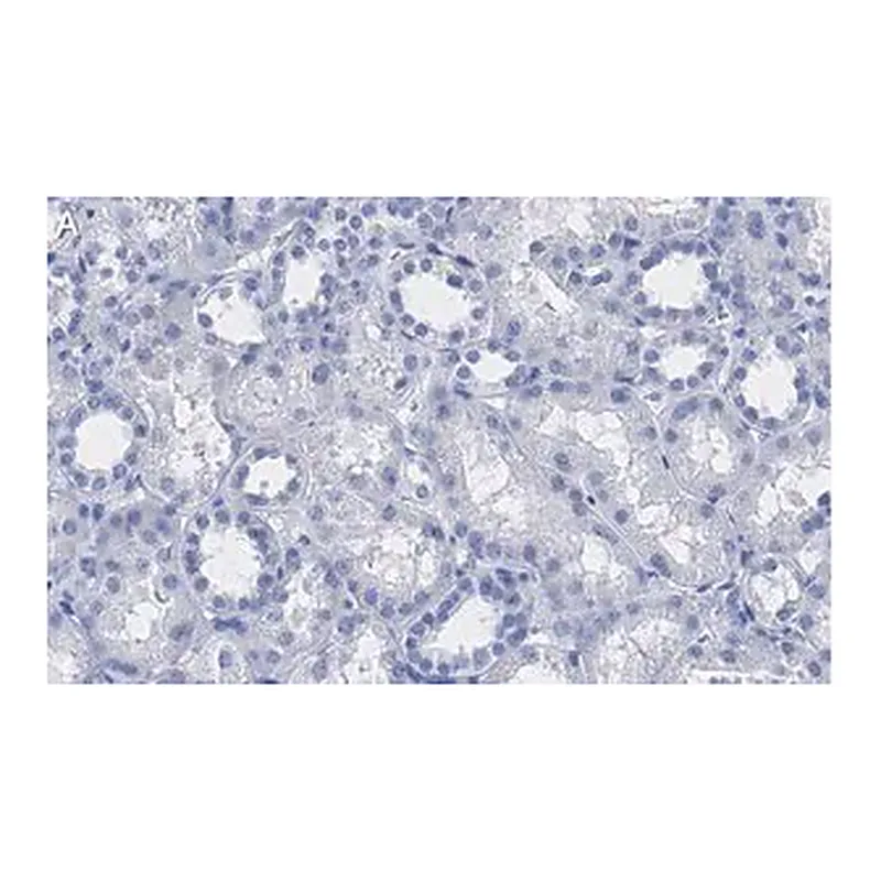 Merck Anti-VDAC1 Antibody, clone 3M22, ZooMAb Rabbit Monoclonal