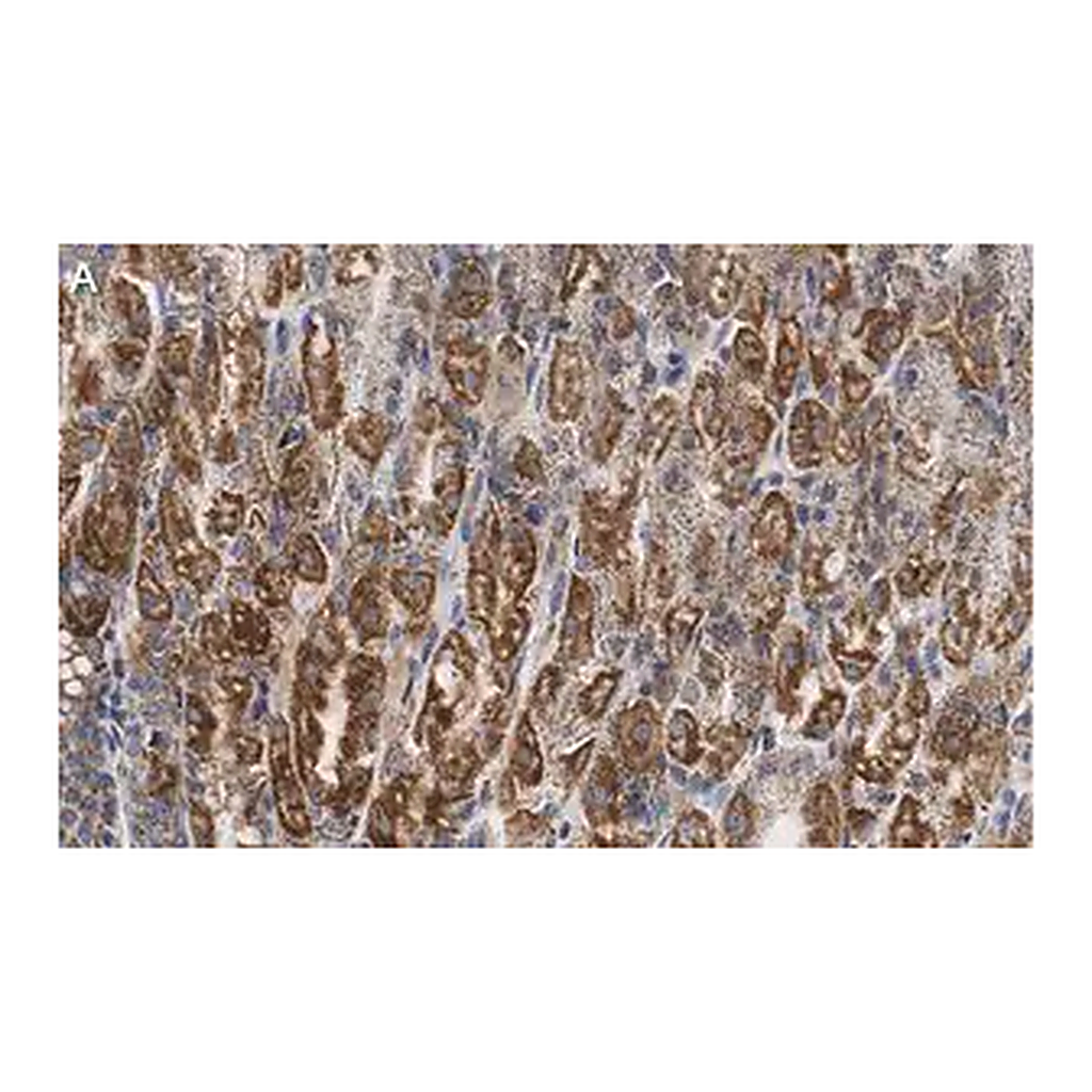 Merck Anti-PNPT1 Antibody, clone 2D23 ZooMAb Rabbit Monoclonal