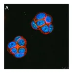 Merck Anti-Ubiquilin 4 Antibody, clone 5K6 ZooMAb Rabbit Monoclonal